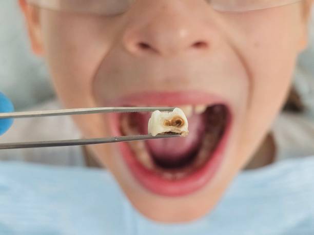 Best After-Hours Emergency Dentist in Greenbriar, FL